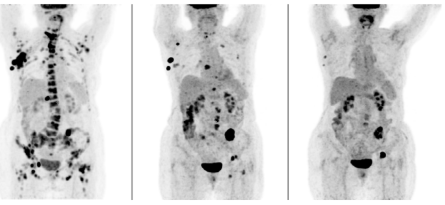 theranostics image
